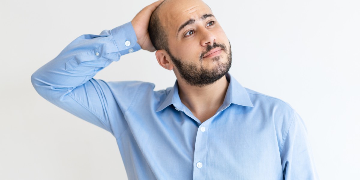 Non-prescription hair loss solutions 2025