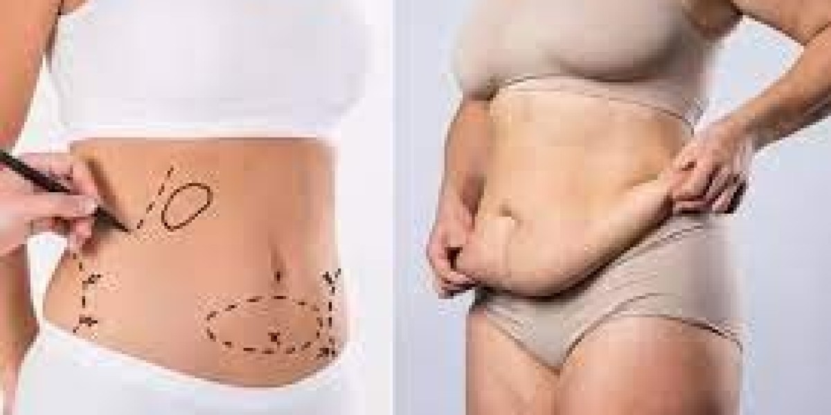 How to Plan Your Plastic Surgery in Islamabad for Safe and Effective Results