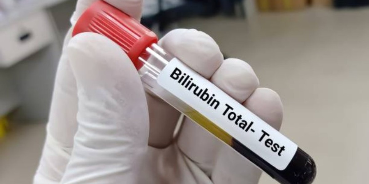 Adult Bilirubin Levels