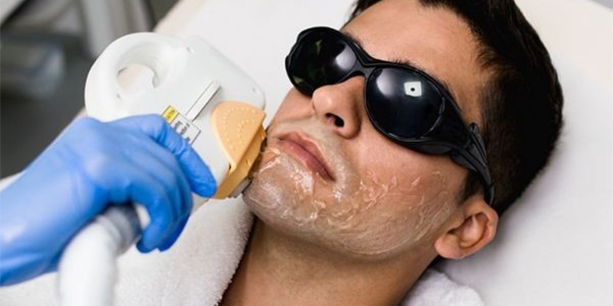 Laser Hair Removal in Islamabad for Sensitive Skin: What You Need to Know