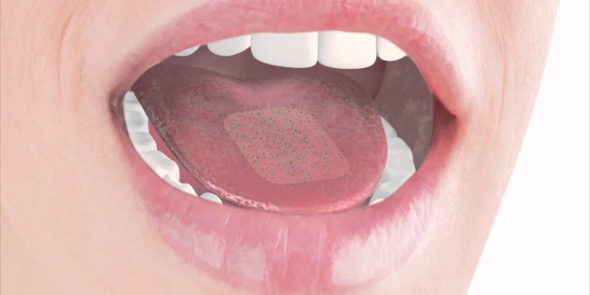 Thin-Film Drug Delivery Technologies Shaping the Oral Thin Films Market