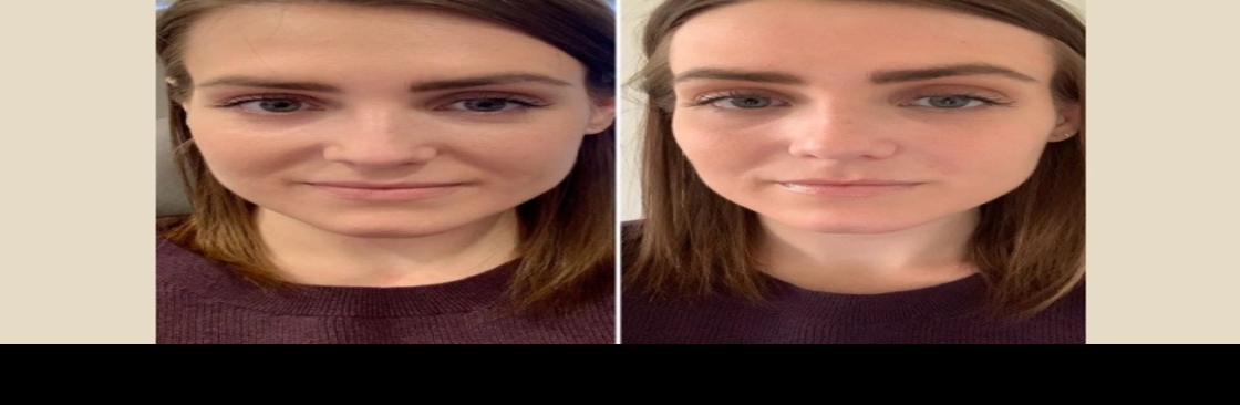 prptreatment dubai Cover Image