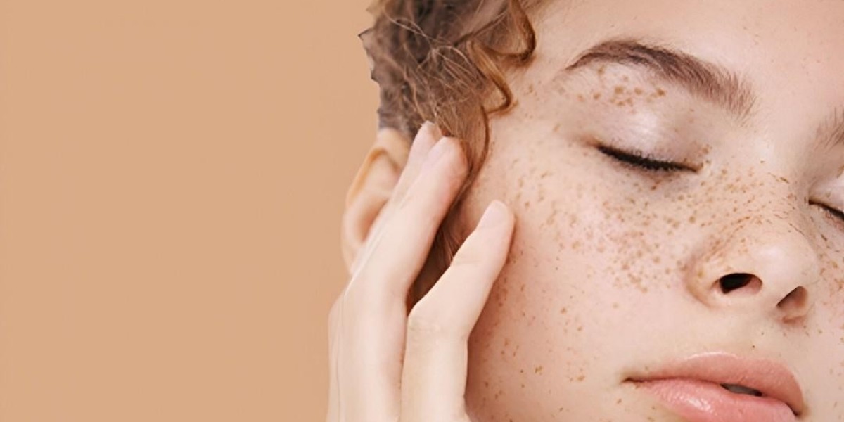 Is Skin Pigmentation Holding Back Clear Skin?