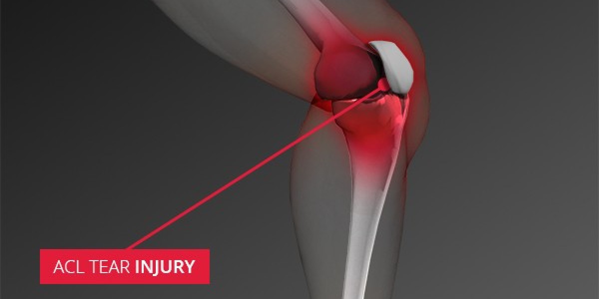 Understanding ACL Injuries Groin Pain and Achilles Tendinopathy