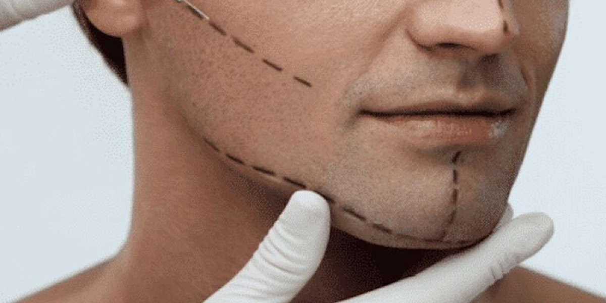 Jaw Surgery in Islamabad – Expert Surgical Techniques