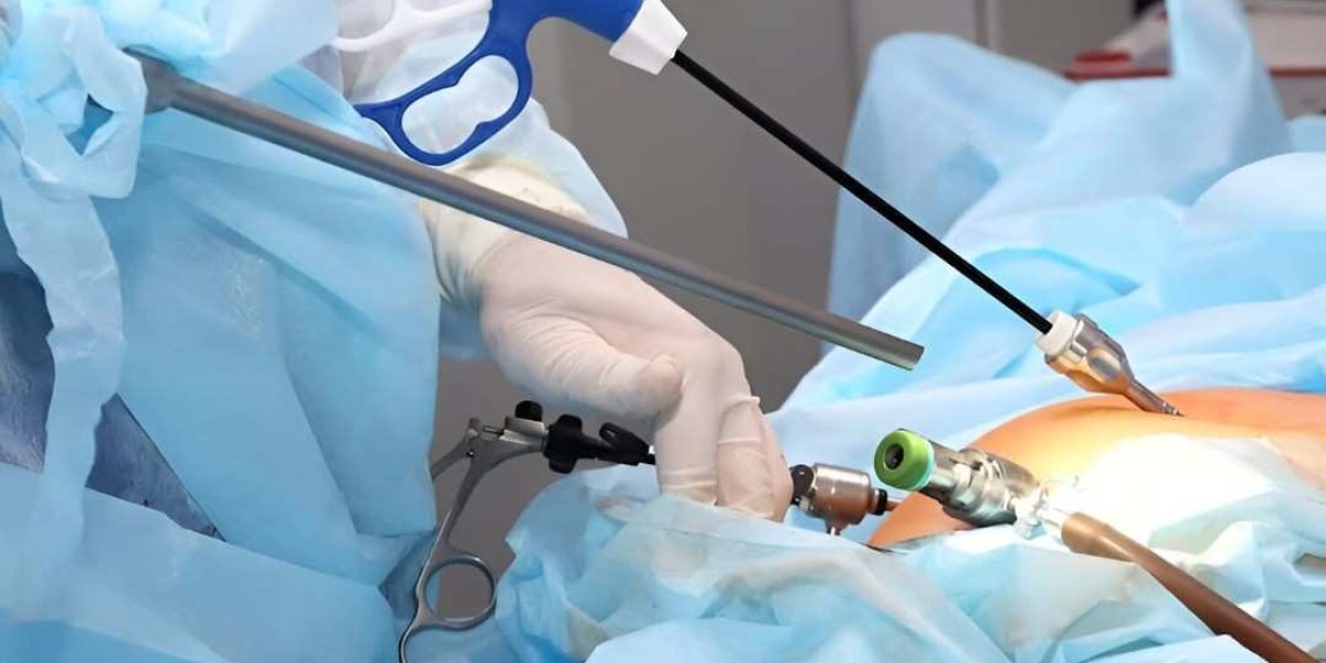 Life-Enhancing Surgery: Laparoscopic in Islamabad