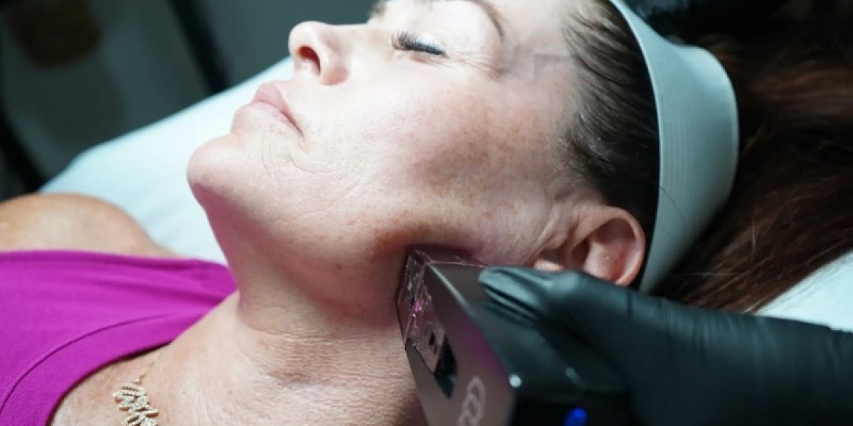 Reveal Glowing Texture Effortlessly with Morpheus8 in Dubai