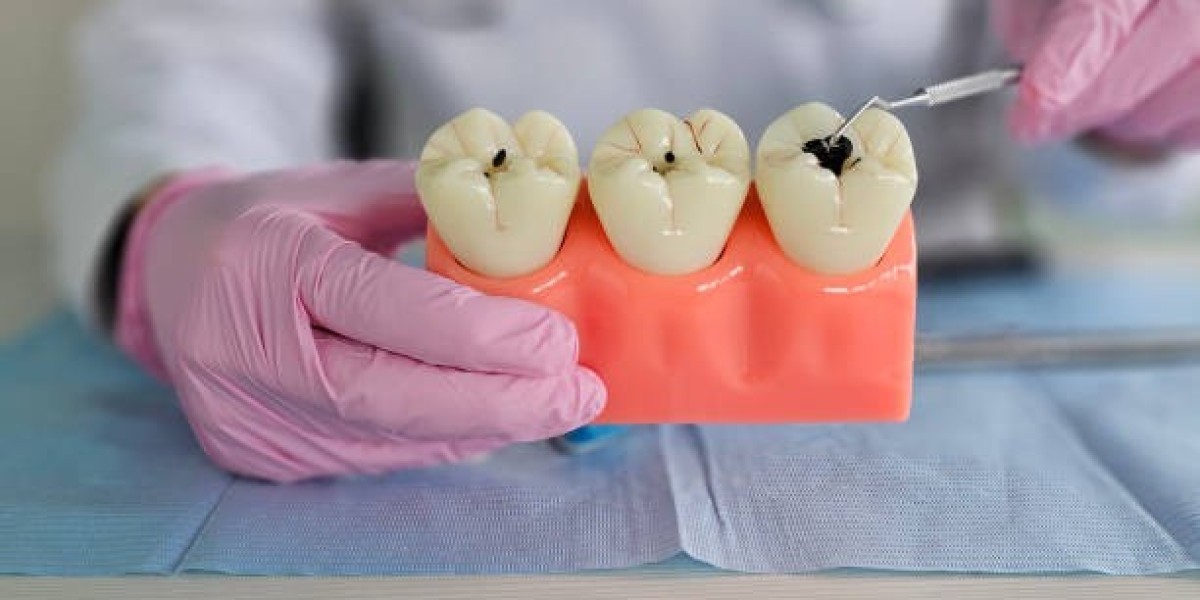 Reliable Dental Fillings in Islamabad for Healthy Smiles