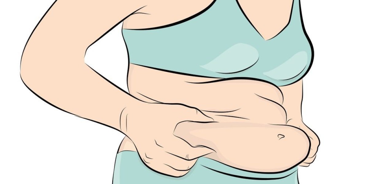 Transform Your Abdominal Contour with Abdominoplasty in Islamabad